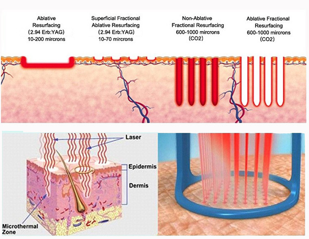 co2 treatment principle