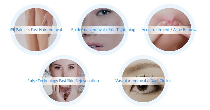 opt ipl laser application