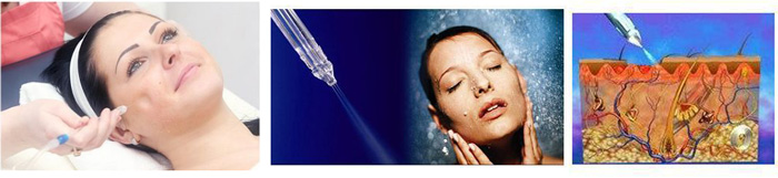 Water & Oxygen Jet Facial Machine Treatment